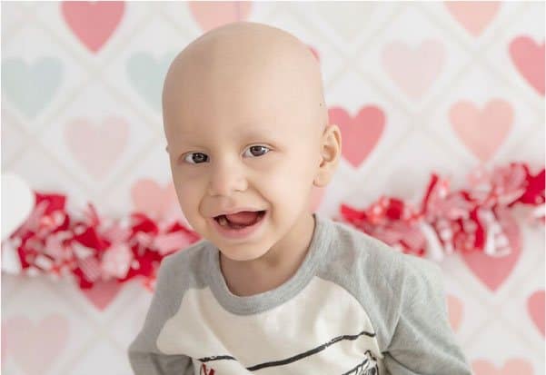 Image of a Bald Little Boy at a Valentine's Party